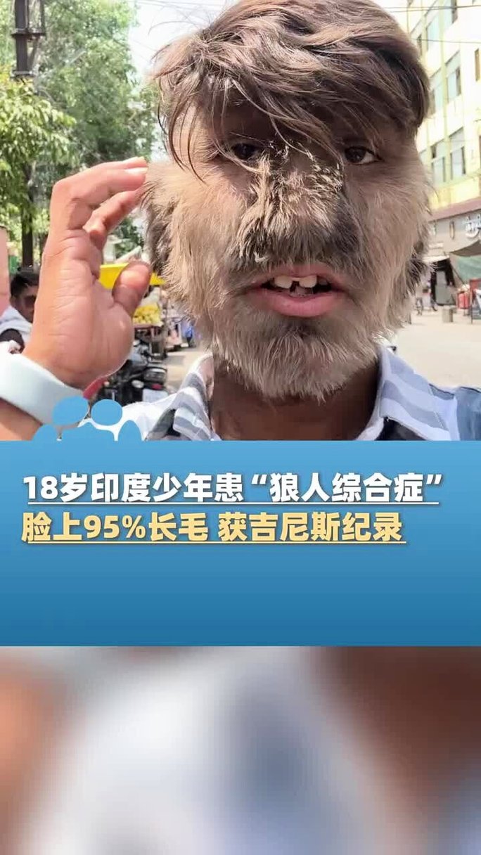 女士下面流黄色分泌物的相关介绍